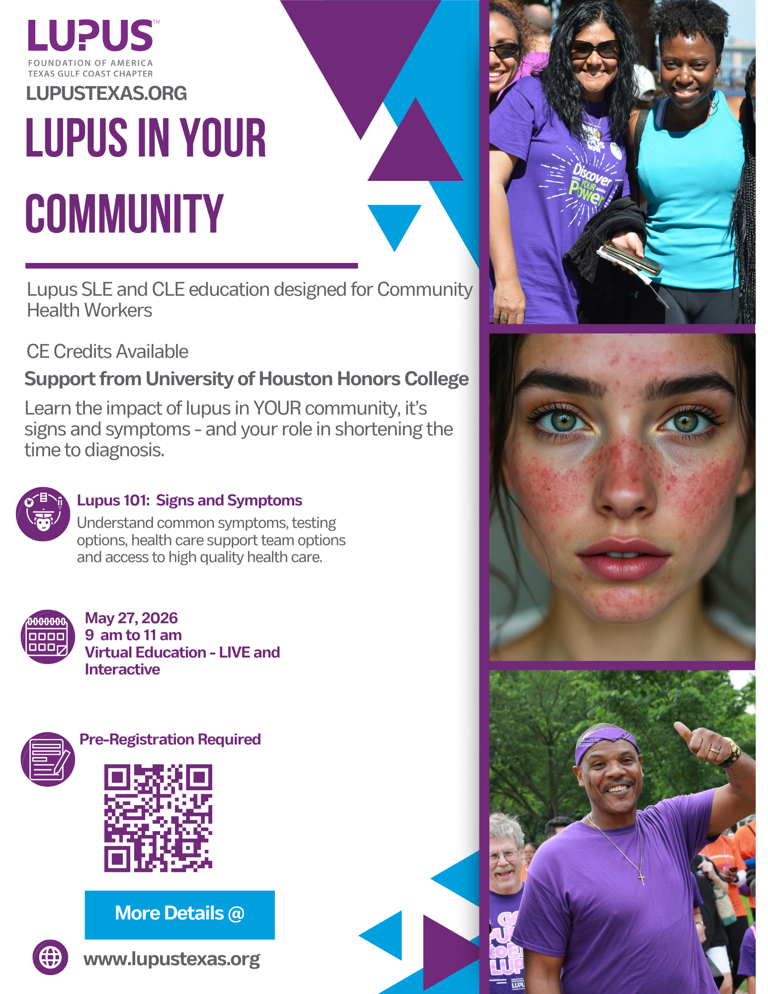 Lupus 101 Signs & Symptoms: Empowering Community Health Workers to Educate & Advocate